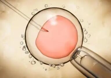 试管移植前胚胎融合的等级分别是什么，四个等级解读